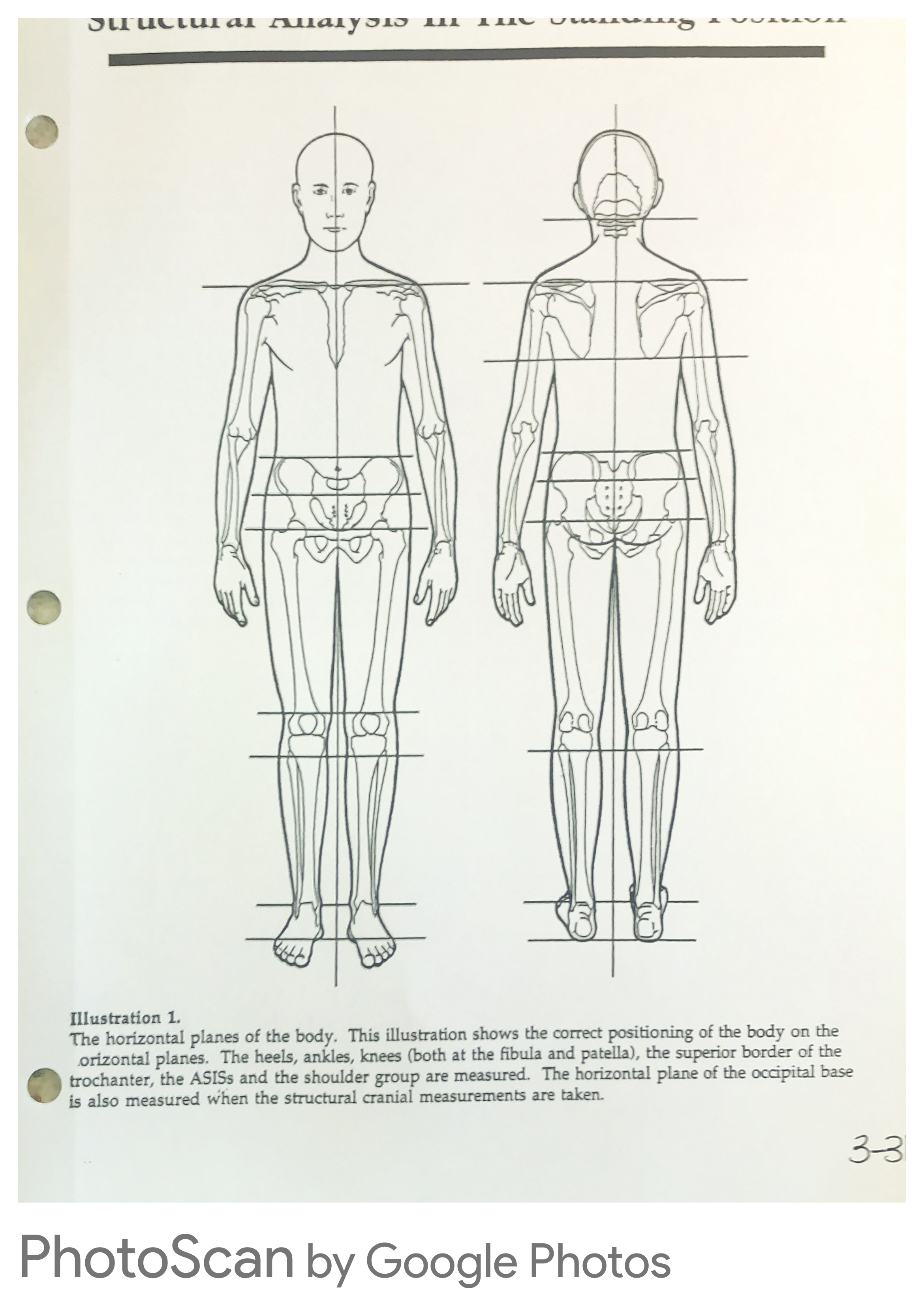 Structural analysis in the standing position — horizontal planes anterior and posterior view