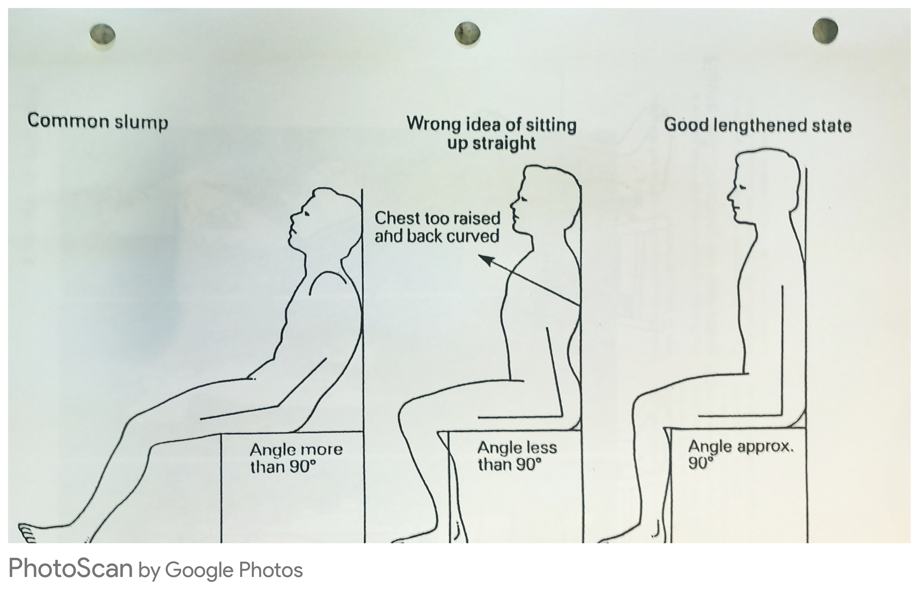 Sitting posture — common slump, wrong idea of sitting straight, good lengthened state