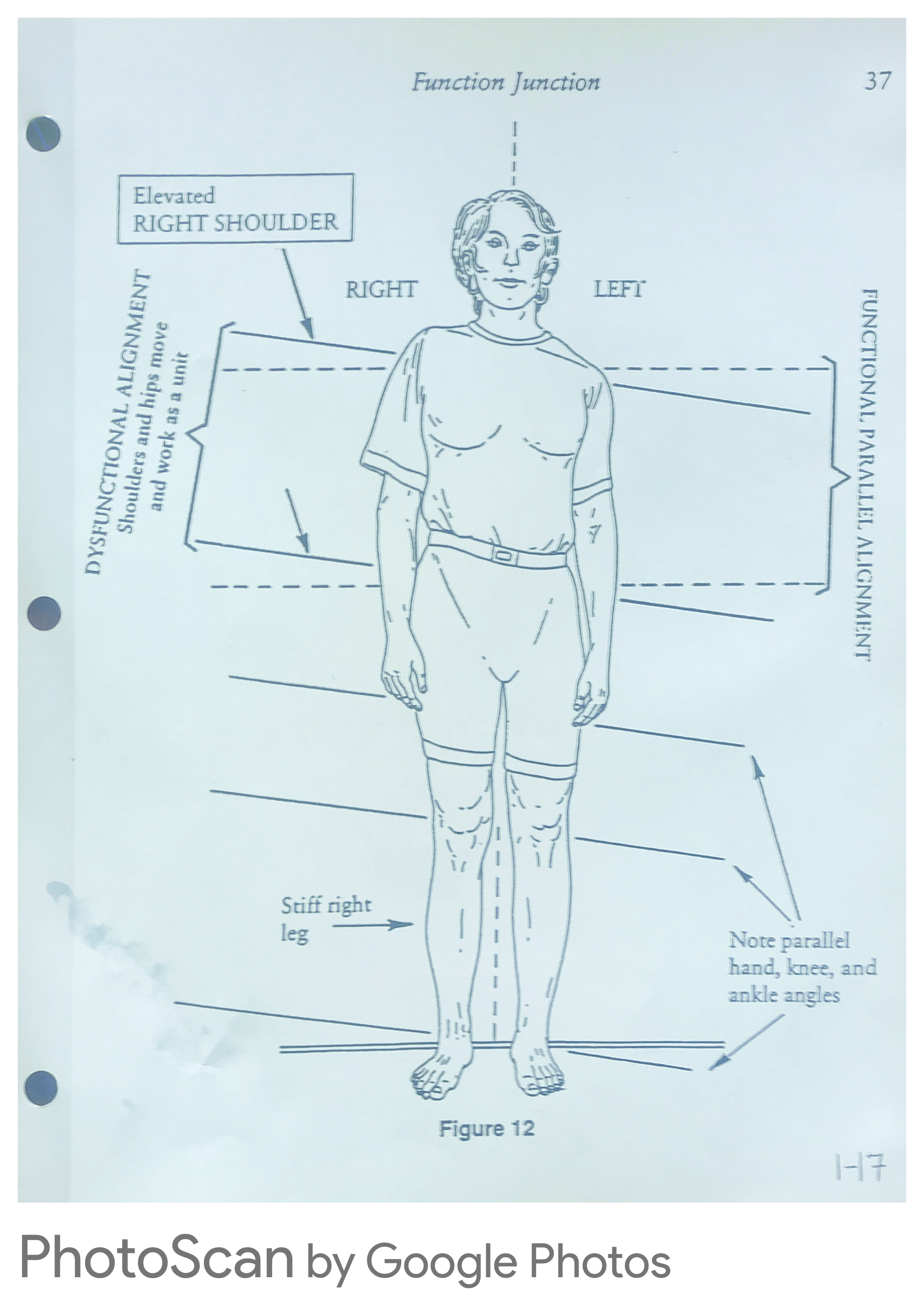 Dysfunctional vs. functional parallel alignment — elevated right shoulder, stiff right leg