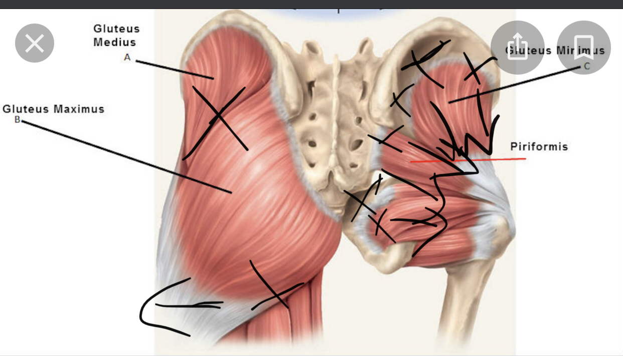 Gluteus Medius, Maximus, Minimus, and Piriformis — annotated release directions