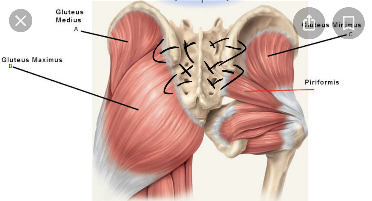 Gluteus and sacrum release — posterior view with annotated fascial directions