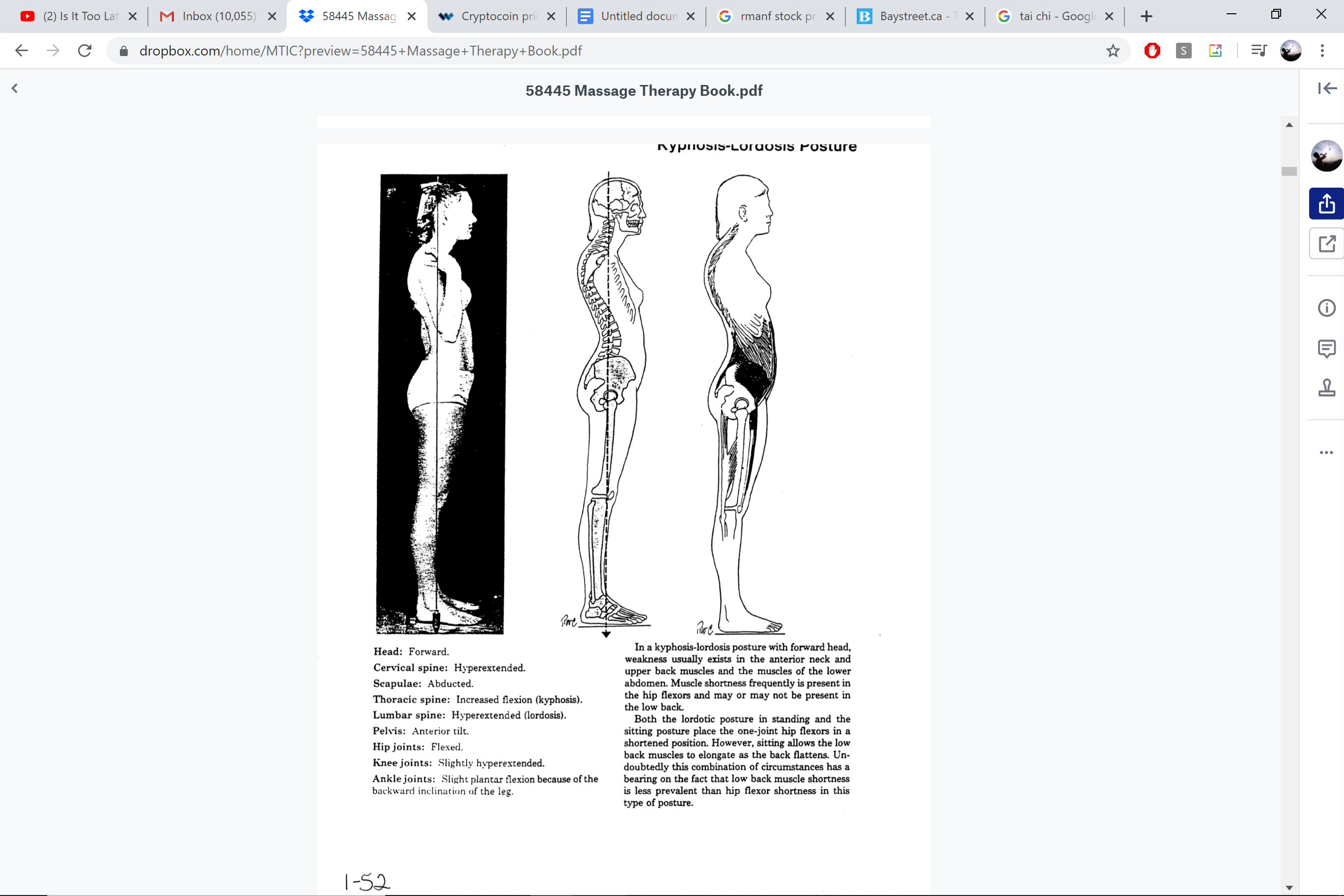 Kyphosis-lordosis posture diagram