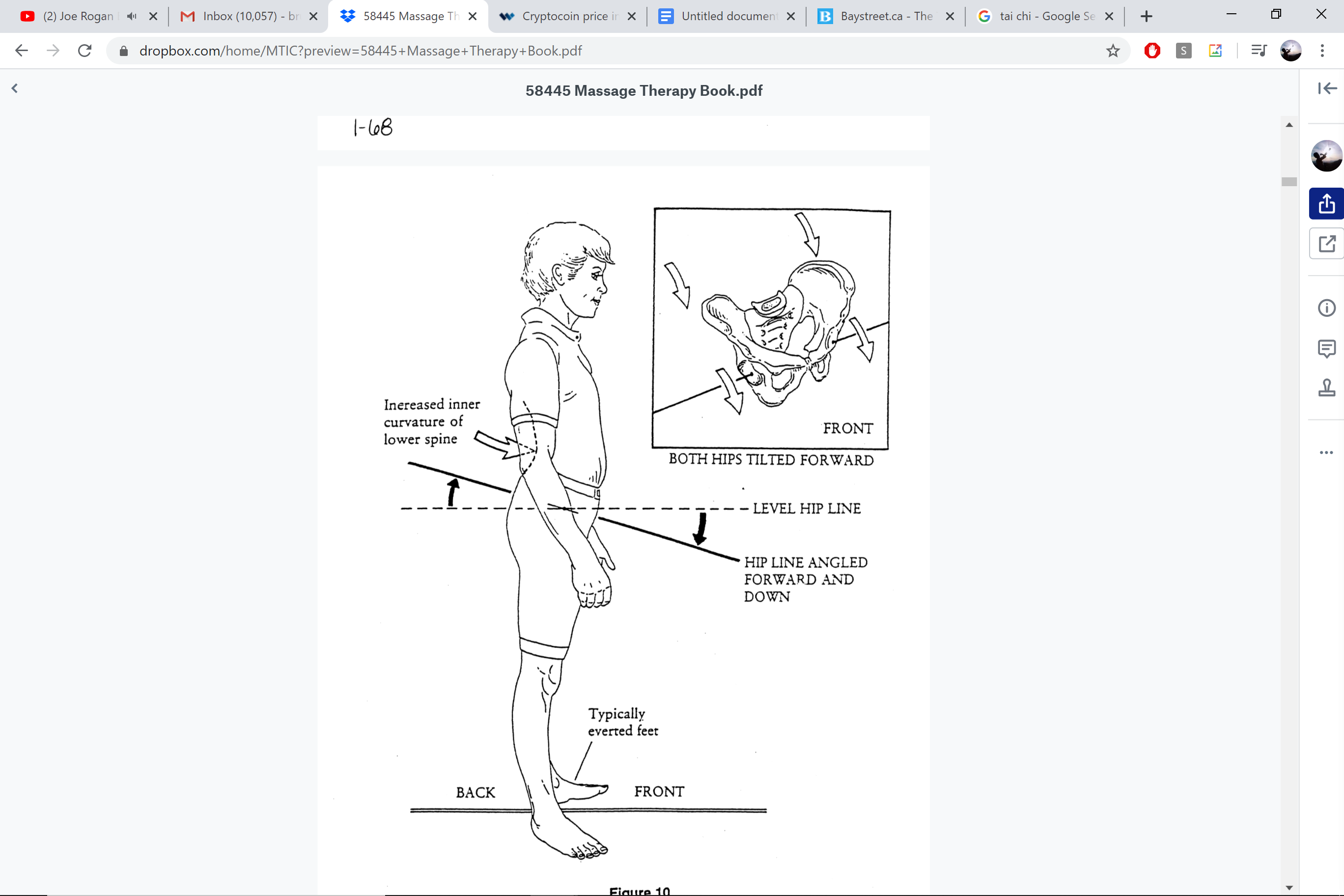 Anterior pelvic tilt — both hips tilted forward with inset pelvic anatomy