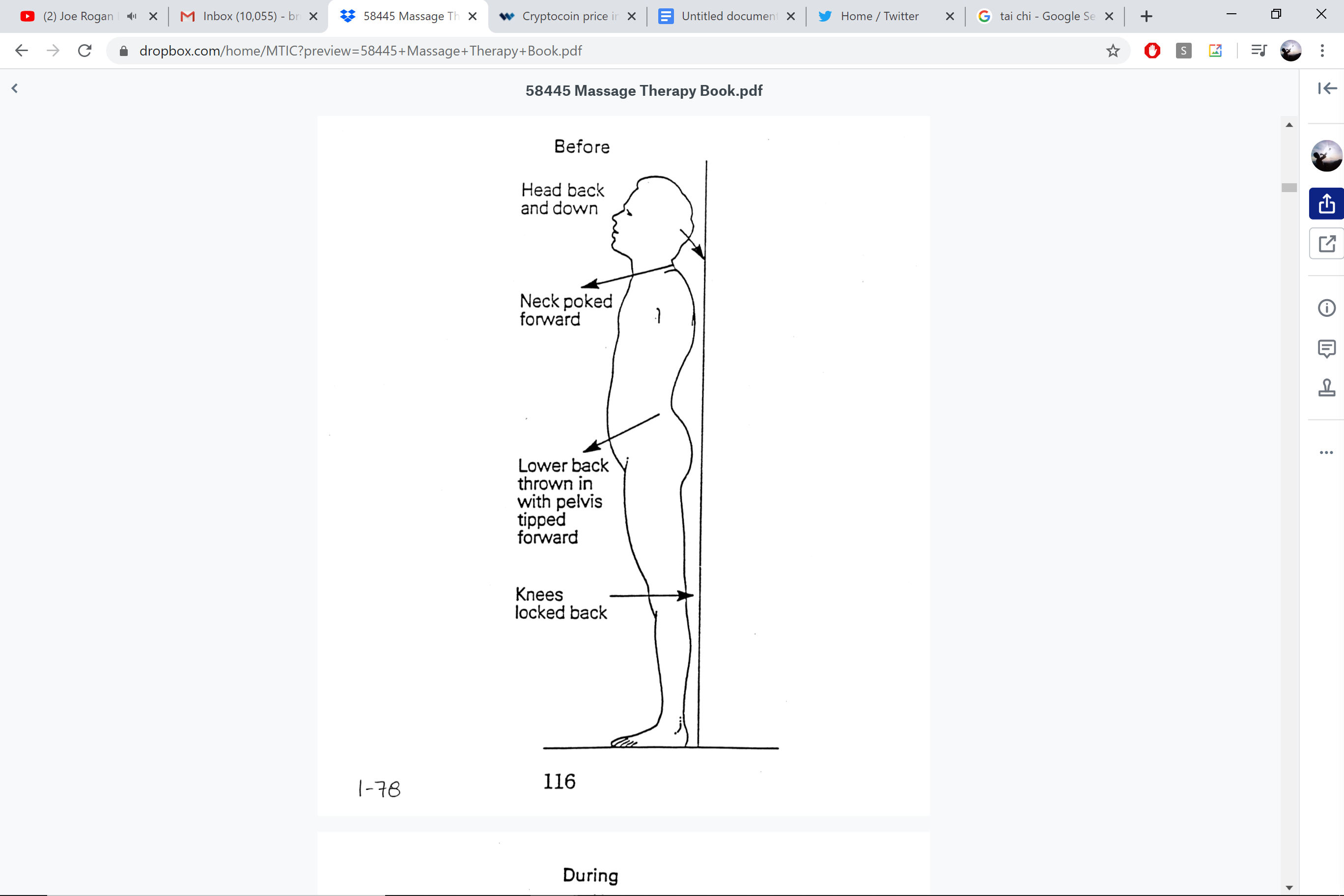Before postural correction — forward head, neck poked, lower back curved, knees locked