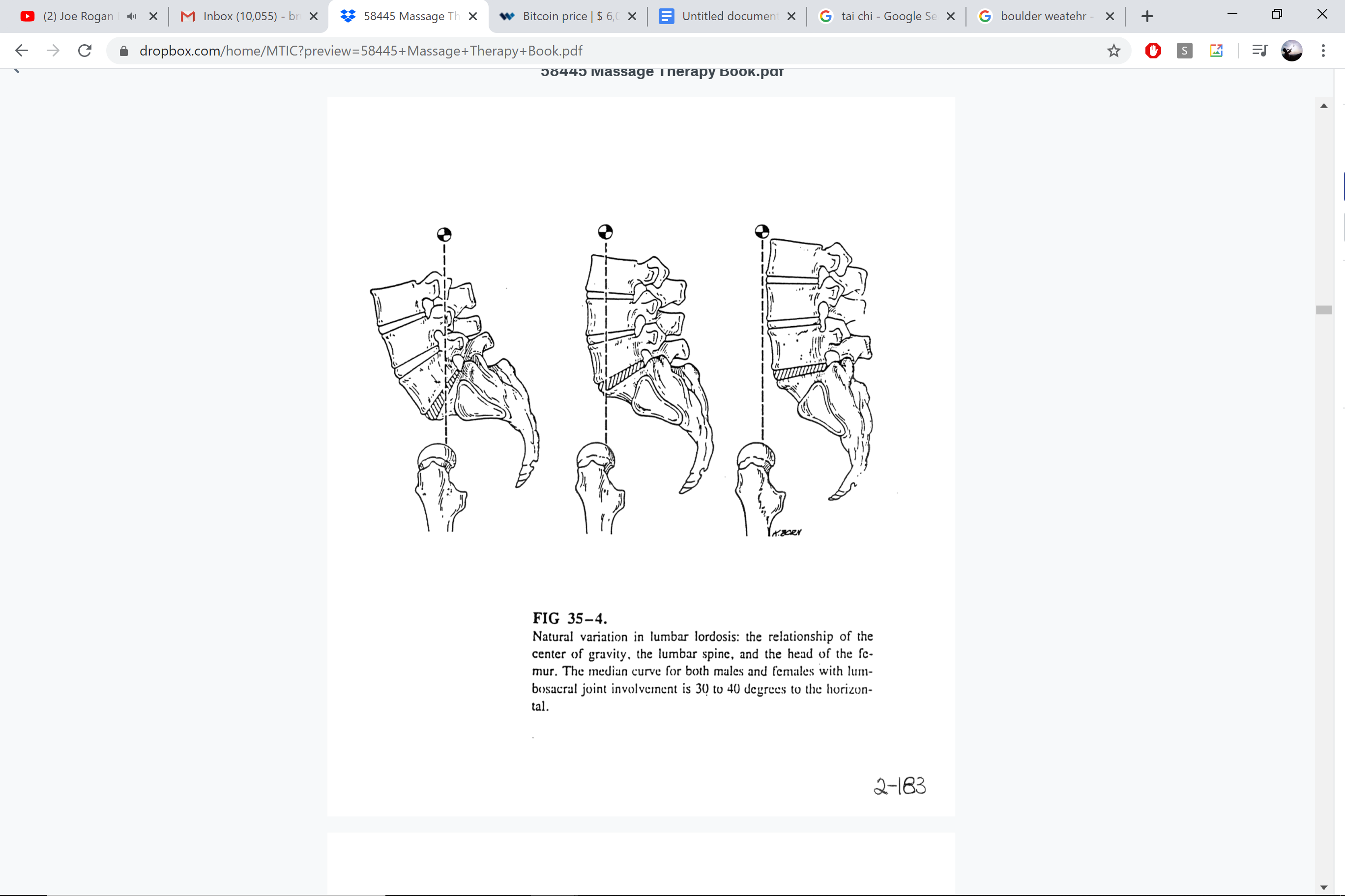 Lumbar lordosis variations — flat vs. normal vs. increased curve
