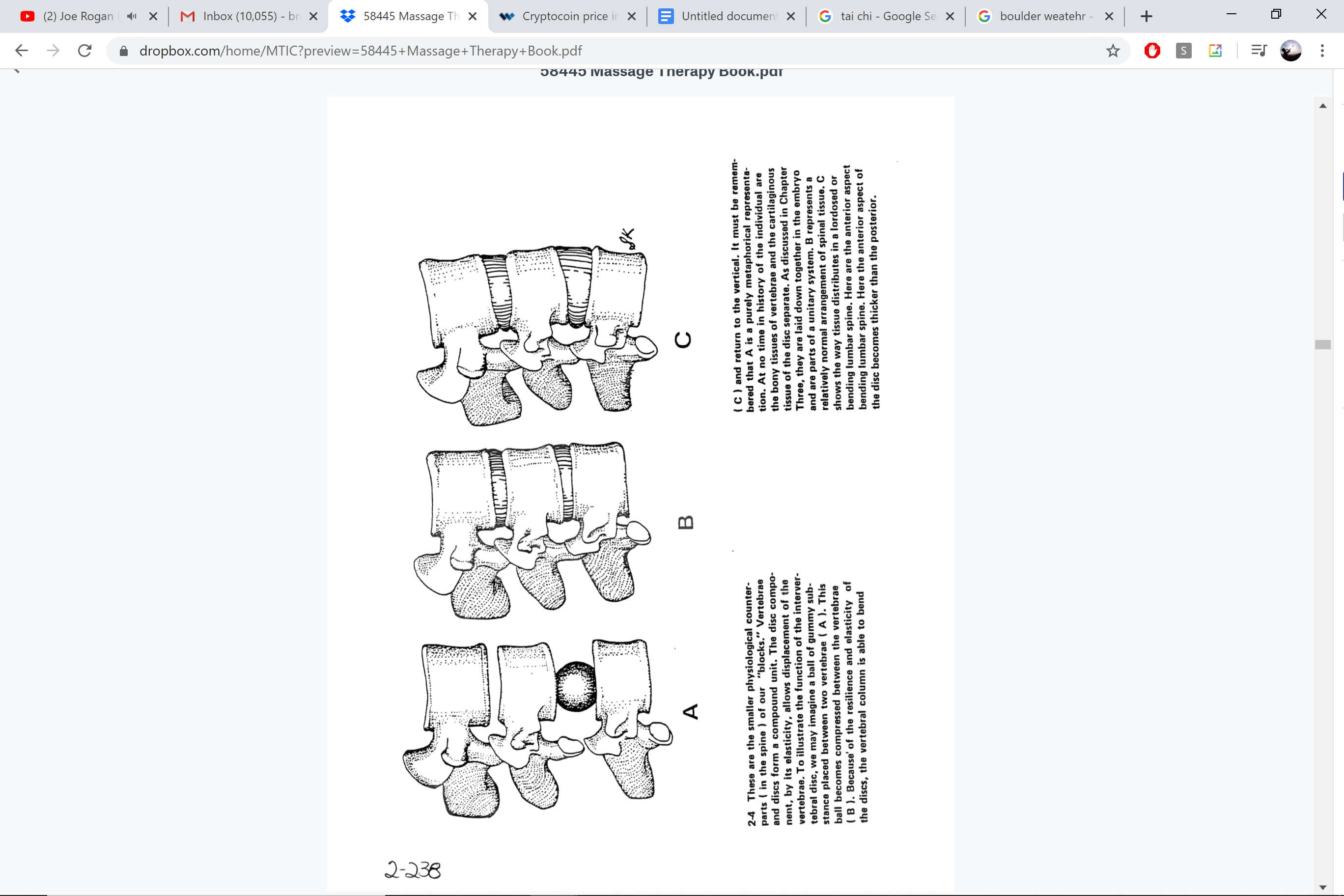 Vertebral disc — ABC views showing compression and disc pressure zones