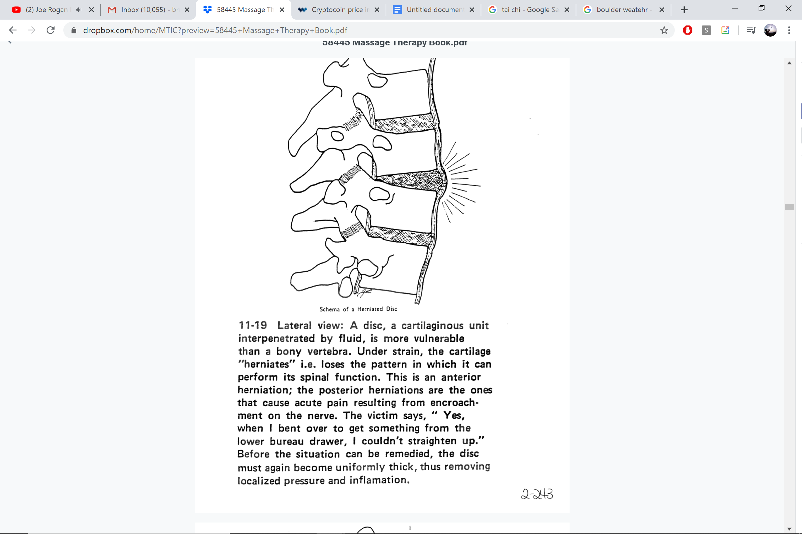 Schema of a herniated disc — lateral view