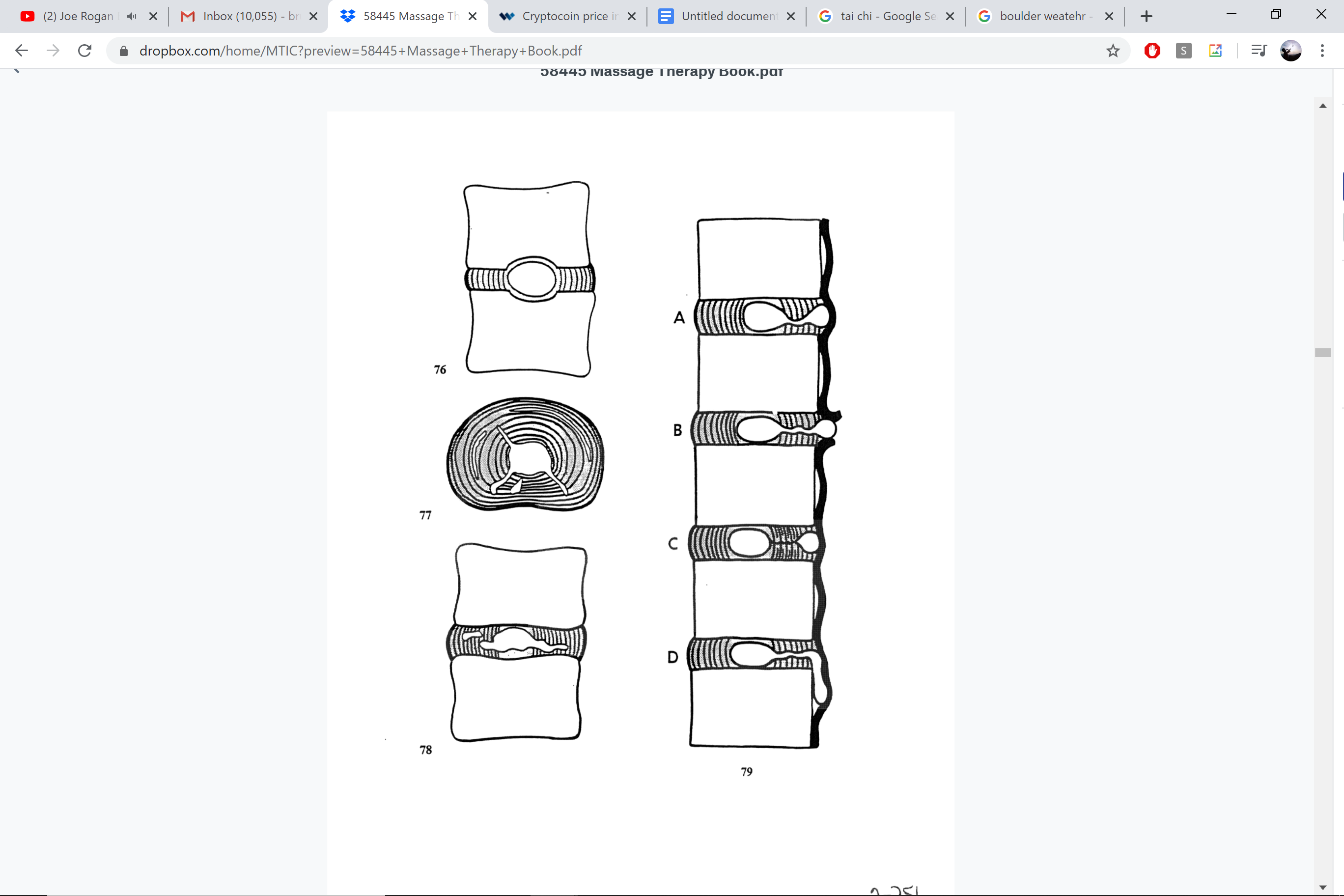 Intervertebral disc components — nucleus pulposus, annulus fibrosus, end plates